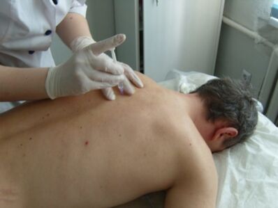 Ενδαρθρικές ενέσεις χονδροπροστατευτικών για θωρακική οστεοχόνδρωση